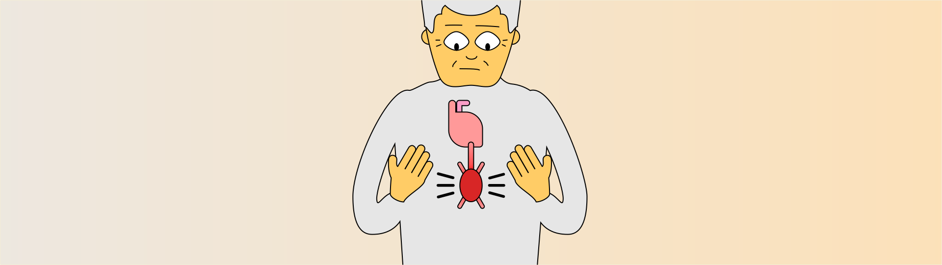 Ilustração de uma pessoa com um aneurisma na artéria aorta.